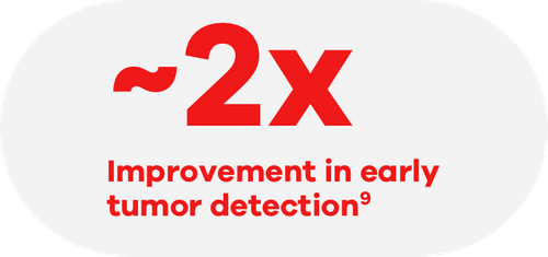 About two times improvement in early tumor detection